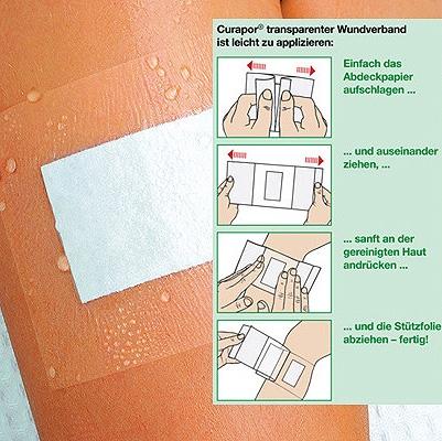 Curapor Wundverband transparent 7 x 5 cm (4 x 2,5) steril wasserdicht 25 Stück aSpr